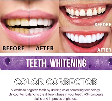 Toothpaste for Teeth Whitening